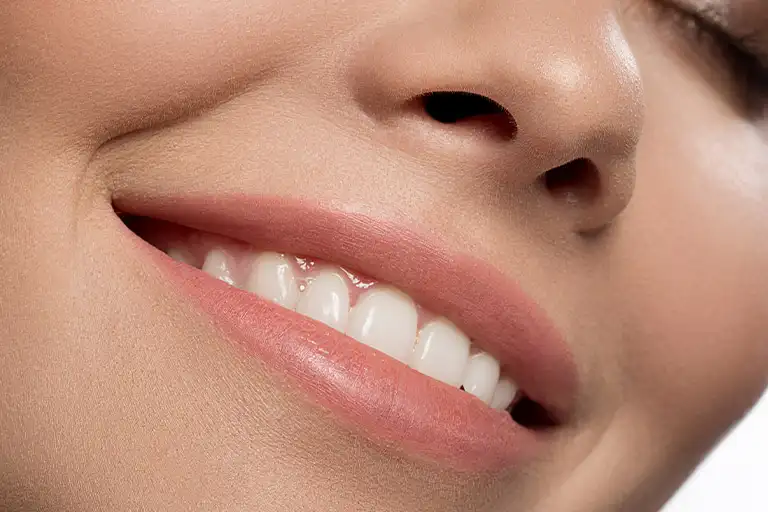 woman smiling with beautiful teeth